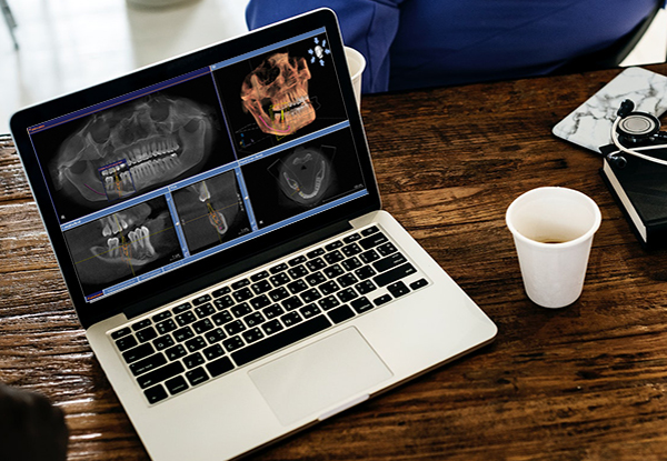 CT-jovairas-2 CT-jovairas-2